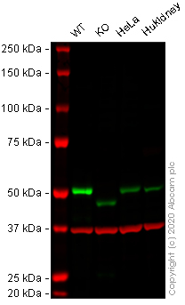 Western blot - Anti-Smad3 antibody [EPR19686] - BSA and Azide free (AB251490), expandable thumbnail
