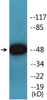Western blot - Anti-Smad3 (phospho S208) antibody (AB138659), expandable thumbnail