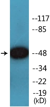Western blot - Anti-Smad3 (phospho S208) antibody (AB138659)