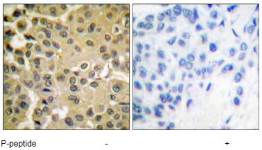 Immunohistochemistry (Formalin/PFA-fixed paraffin-embedded sections) - Anti-Smad3 (phospho S425) antibody (AB51177)