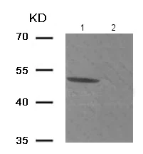 Western blot - Anti-Smad3 (phospho T179) antibody (AB193297)