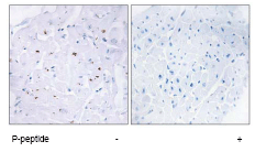 Immunohistochemistry (Formalin/PFA-fixed paraffin-embedded sections) - Anti-Smad3 (phospho T179) antibody (AB74062), expandable thumbnail