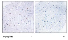 Immunohistochemistry (Formalin/PFA-fixed paraffin-embedded sections) - Anti-Smad3 (phospho T179) antibody (AB74062)