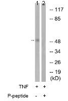 Western blot - Anti-Smad3 (phospho T179) antibody (AB74062), expandable thumbnail
