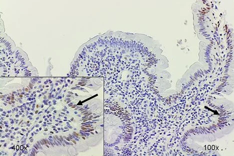 Immunohistochemistry (Formalin/PFA-fixed paraffin-embedded sections) - Anti-SMAD3 (pS423/425) + SMAD5 (pS463/465 ) + SMAD1 (pS463/465) + SMAD2 (pS465/467) antibody [EP823Y] (AB52903)