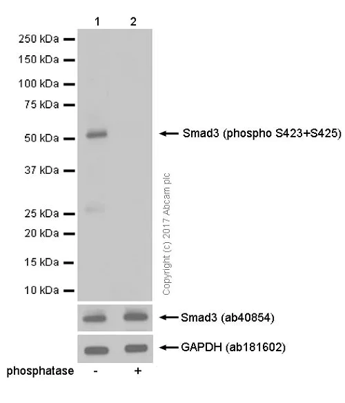 Western blot - Anti-SMAD3 (pS423/425) + SMAD5 (pS463/465) + SMAD1 (pS463/465) + SMAD2 (pS465/467) antibody [EP823Y] (AB52903)