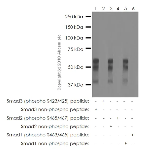 Western blot - Anti-SMAD3 (pS423/425) + SMAD5 (pS463/465) + SMAD1 (pS463/465) + SMAD2 (pS465/467) antibody [EP823Y] (AB52903)