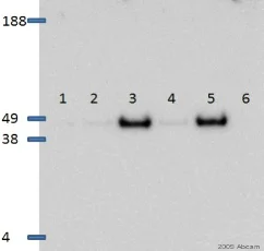 Western blot - Anti-SMAD3 (pS423/425) + SMAD5 (pS463/465) + SMAD1 (pS463/465) + SMAD2 (pS465/467) antibody [EP823Y] (AB52903)