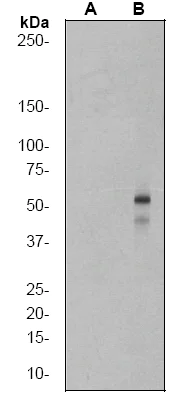 Western blot - Anti-SMAD3 (pS423/425) + SMAD5 (pS463/465) + SMAD1 (pS463/465) + SMAD2 (pS465/467) antibody [EP823Y] (AB52903)