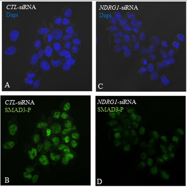 Immunocytochemistry/ Immunofluorescence - Anti-SMAD3 (pS423/425) + SMAD5 (pS463/465 ) + SMAD1 (pS463/465) + SMAD2 (pS465/467) antibody [EP823Y] - BSA and Azide free (AB172202), expandable thumbnail