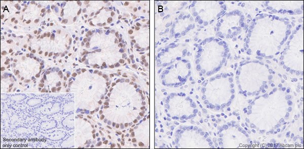 Immunohistochemistry (Formalin/PFA-fixed paraffin-embedded sections) - Anti-SMAD3 (pS423/425) + SMAD5 (pS463/465 ) + SMAD1 (pS463/465) + SMAD2 (pS465/467) antibody [EP823Y] - BSA and Azide free (ab172202), expandable thumbnail