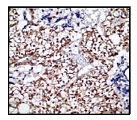 Immunohistochemistry (Formalin/PFA-fixed paraffin-embedded sections) - Anti-SMAD3 (pS423/425) + SMAD5 (pS463/465 ) + SMAD1 (pS463/465) + SMAD2 (pS465/467) antibody [EP823Y] - BSA and Azide free (ab172202), expandable thumbnail