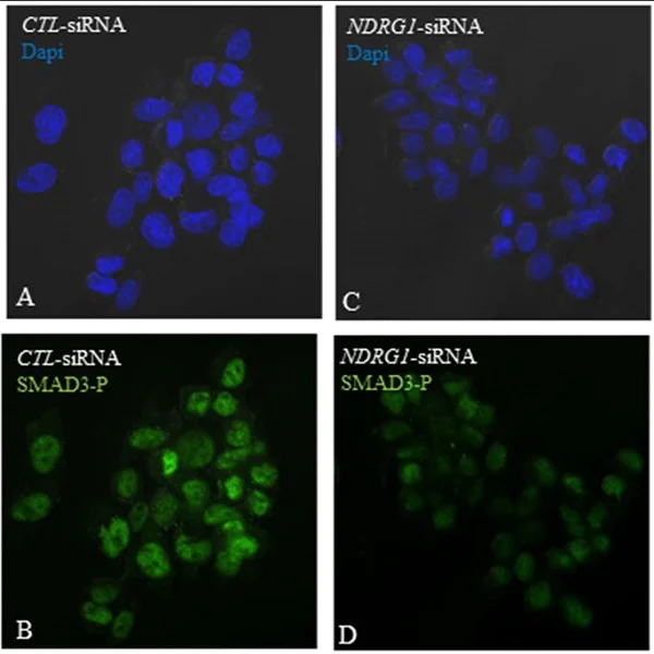 Immunocytochemistry/ Immunofluorescence - Anti-SMAD3 (pS423/425)+SMAD5&SMAD1 (pS463/465)+SMAD2 (pS465/467) antibody [EP823Y] - BSA&Azide free (AB172202)