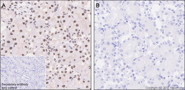 Immunohistochemistry (Formalin/PFA-fixed paraffin-embedded sections) - Anti-SMAD3 (pS423/425) + SMAD5 (pS463/465 ) + SMAD1 (pS463/465) + SMAD2 (pS465/467) antibody [EP823Y] - BSA and Azide free (AB172202)