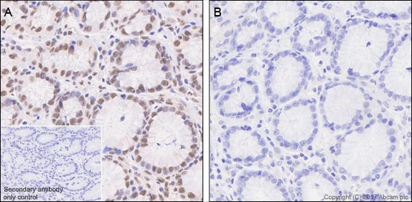 Immunohistochemistry (Formalin/PFA-fixed paraffin-embedded sections) - Anti-SMAD3 (pS423/425) + SMAD5 (pS463/465 ) + SMAD1 (pS463/465) + SMAD2 (pS465/467) antibody [EP823Y] - BSA and Azide free (AB172202)