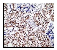 Immunohistochemistry (Formalin/PFA-fixed paraffin-embedded sections) - Anti-SMAD3 (pS423/425) + SMAD5 (pS463/465 ) + SMAD1 (pS463/465) + SMAD2 (pS465/467) antibody [EP823Y] - BSA and Azide free (AB172202)