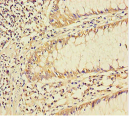 Immunohistochemistry (Formalin/PFA-fixed paraffin-embedded sections) - Anti-Smad4 antibody (AB236321)