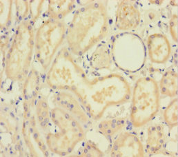 Immunohistochemistry (Formalin/PFA-fixed paraffin-embedded sections) - Anti-Smad4 antibody (AB236321)