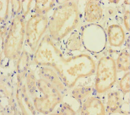 Immunohistochemistry (Formalin/PFA-fixed paraffin-embedded sections) - Anti-Smad4 antibody (AB236321)