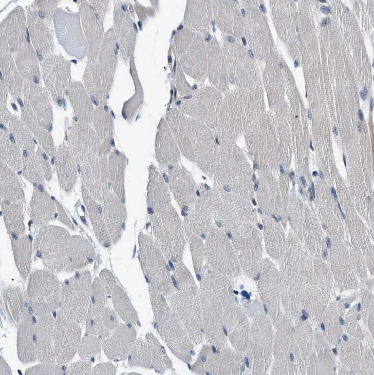 Immunohistochemistry (Formalin/PFA-fixed paraffin-embedded sections) - Anti-Smad4 antibody (AB244370)