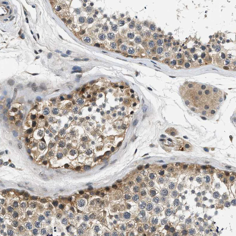 Immunohistochemistry (Formalin/PFA-fixed paraffin-embedded sections) - Anti-Smad4 antibody (AB244370)