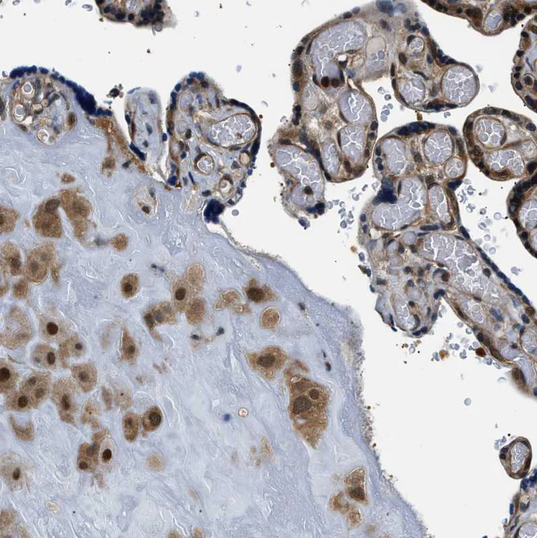Immunohistochemistry (Formalin/PFA-fixed paraffin-embedded sections) - Anti-Smad4 antibody (AB244370)