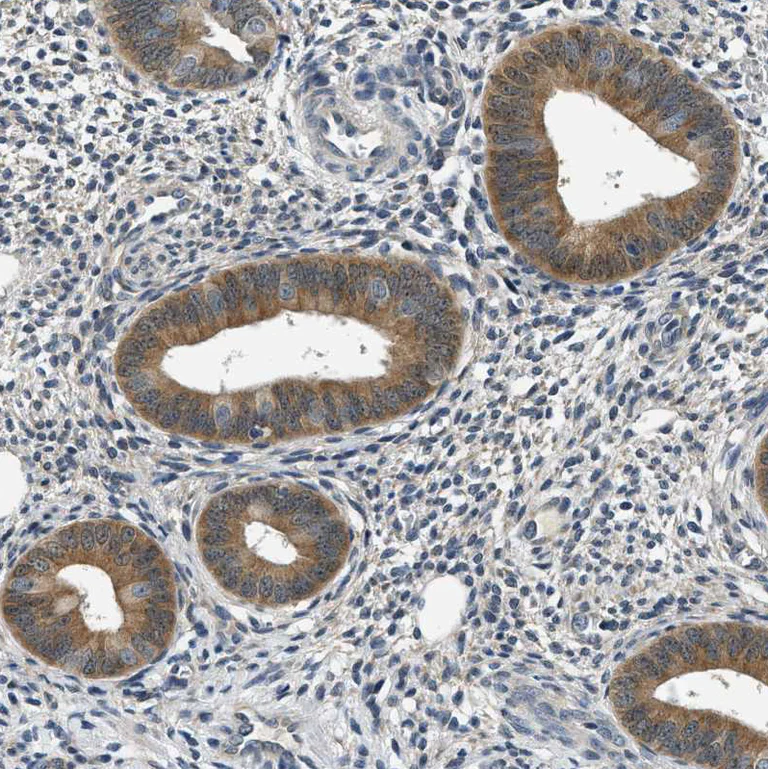Immunohistochemistry (Formalin/PFA-fixed paraffin-embedded sections) - Anti-Smad4 antibody (AB244370)
