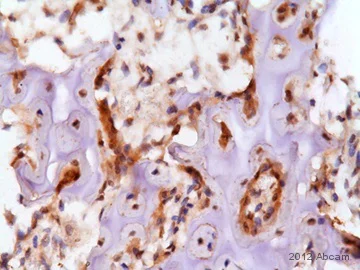 Immunohistochemistry (Formalin/PFA-fixed paraffin-embedded sections) - Anti-Smad4 antibody [EP618Y] (AB40759)