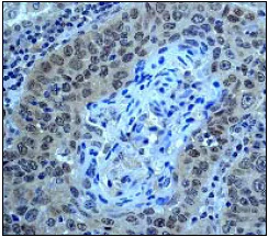 Immunohistochemistry (Formalin/PFA-fixed paraffin-embedded sections) - Anti-Smad4 antibody [EP618Y] (AB40759)