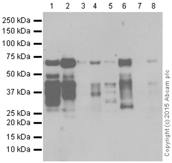 Western blot - Anti-Smad4 antibody [EP618Y] (AB40759)