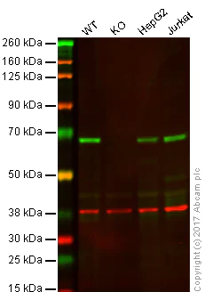 Western blot - Anti-Smad4 antibody [EP618Y] (AB40759)