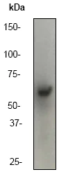 Western blot - Anti-Smad4 antibody [EP618Y] (AB40759)