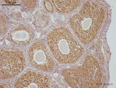 Immunohistochemistry (Formalin/PFA-fixed paraffin-embedded sections) - Anti-Smad4 antibody [EP618Y] - BSA and Azide free (AB215968)