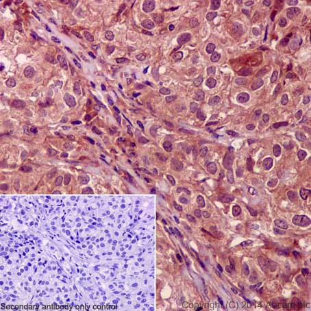 Immunohistochemistry (Formalin/PFA-fixed paraffin-embedded sections) - Anti-Smad4 antibody [EP618Y] - BSA and Azide free (AB215968)