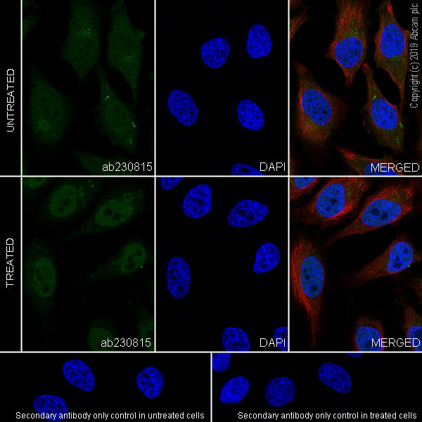 Immunocytochemistry/ Immunofluorescence - Anti-Smad4 antibody [EPR22589-112] (AB230815), expandable thumbnail