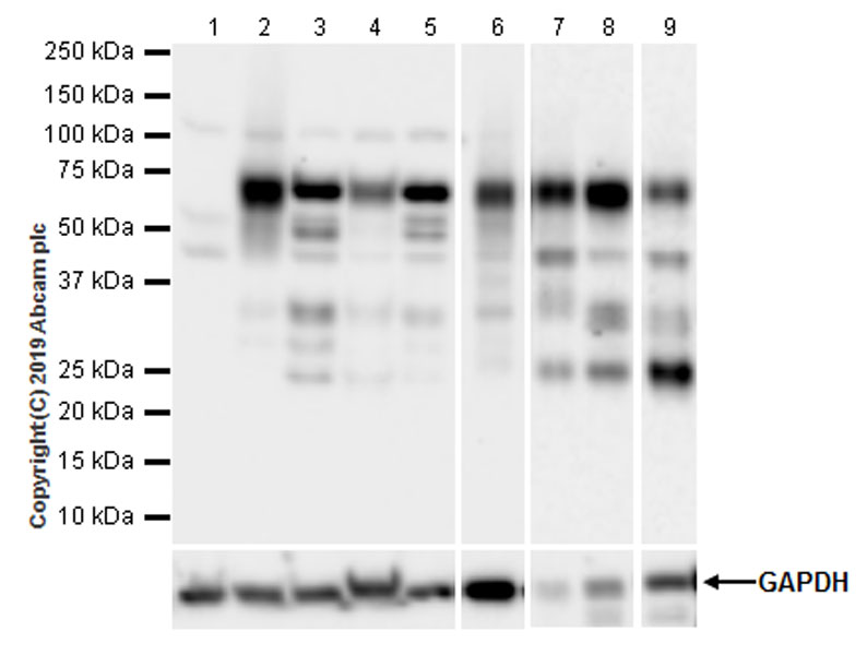 Western blot - Anti-Smad4 antibody [EPR22589-112] (AB230815), expandable thumbnail