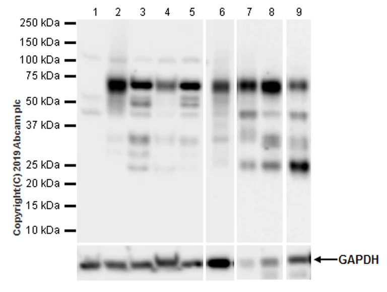 Western blot - Anti-Smad4 antibody [EPR22589-112] (AB230815)