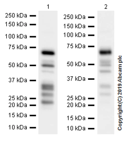 Western blot - Anti-Smad4 antibody [EPR22589-112] (AB230815)