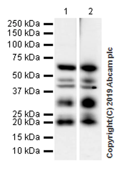Western blot - Anti-Smad4 antibody [EPR22589-112] (AB230815)