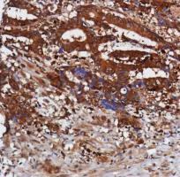 Immunohistochemistry (Formalin/PFA-fixed paraffin-embedded sections) - Anti-Smad4 antibody [SP306] - BSA and Azide free (AB243929)