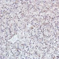 Immunohistochemistry (Formalin/PFA-fixed paraffin-embedded sections) - Anti-Smad4 antibody [SP306] - BSA and Azide free (AB243929)