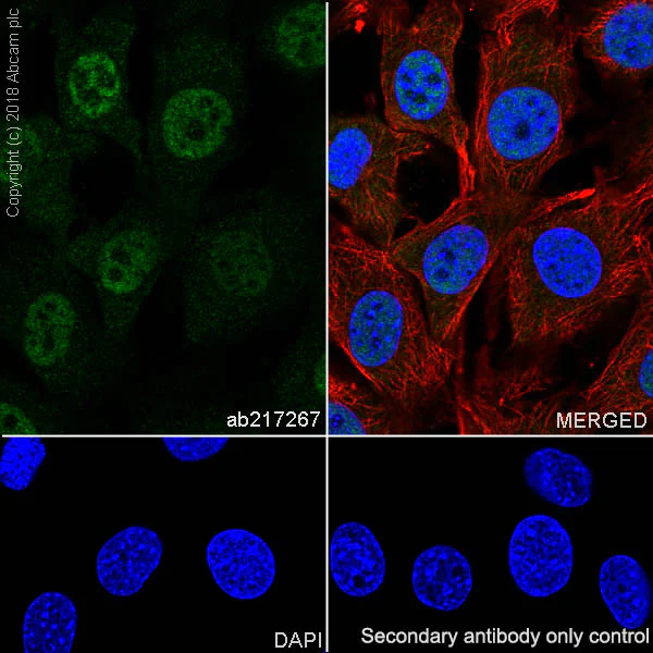 Immunocytochemistry/ Immunofluorescence - Anti-Smad4 antibody [SP306] - C-terminal (AB217267)
