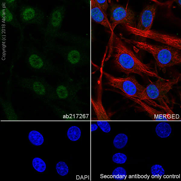 Immunocytochemistry/ Immunofluorescence - Anti-Smad4 antibody [SP306] - C-terminal (AB217267)