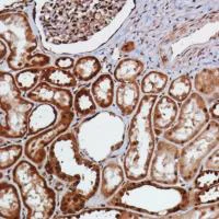 Immunohistochemistry (Formalin/PFA-fixed paraffin-embedded sections) - Anti-Smad4 antibody [SP306] - C-terminal (AB217267)