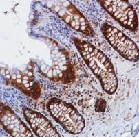 Immunohistochemistry (Formalin/PFA-fixed paraffin-embedded sections) - Anti-Smad4 antibody [SP306] - C-terminal (AB217267)