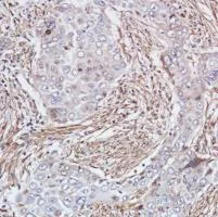 Immunohistochemistry (Formalin/PFA-fixed paraffin-embedded sections) - Anti-Smad4 antibody [SP306] - C-terminal (AB217267)