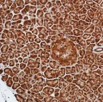 Immunohistochemistry (Formalin/PFA-fixed paraffin-embedded sections) - Anti-Smad4 antibody [SP306] - C-terminal (AB217267)