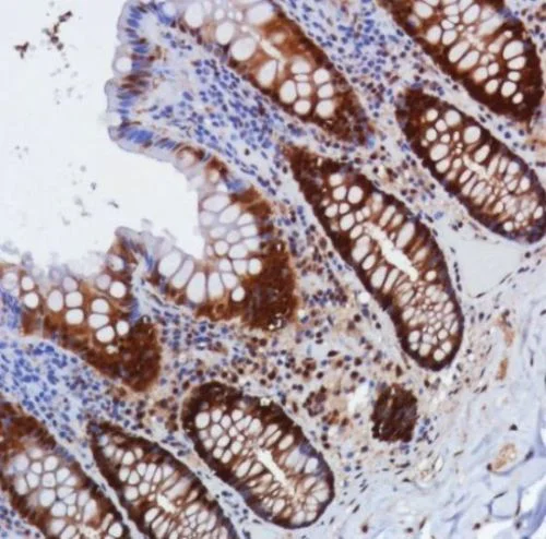 Immunohistochemistry (Formalin/PFA-fixed paraffin-embedded sections) - Anti-Smad4 antibody [SP306] - C-terminal, prediluted (AB228205)