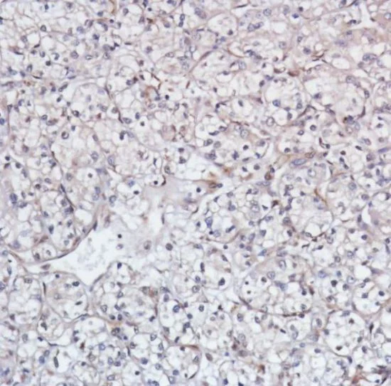 Immunohistochemistry (Formalin/PFA-fixed paraffin-embedded sections) - Anti-Smad4 antibody [SP306] - C-terminal, prediluted (AB228205)