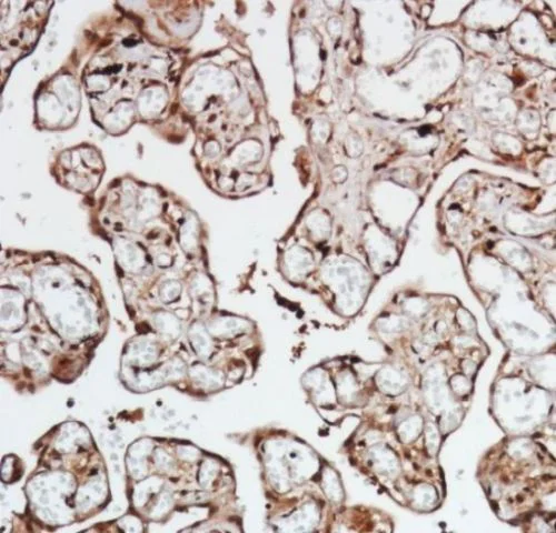 Immunohistochemistry (Formalin/PFA-fixed paraffin-embedded sections) - Anti-Smad4 antibody [SP306] - C-terminal, prediluted (AB228205)